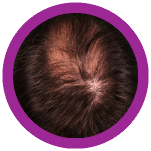 The future of hair therapy